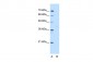 GMPPB antibody - C-terminal region